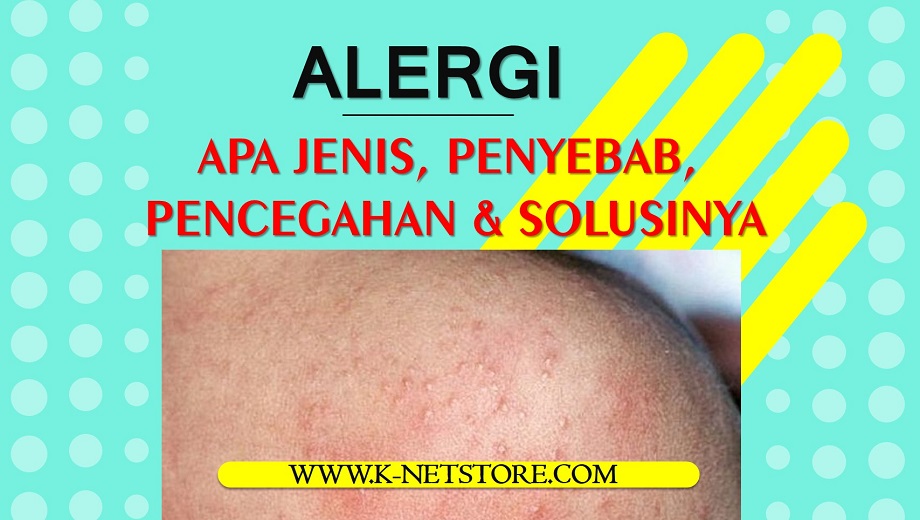 Alergi Alergi