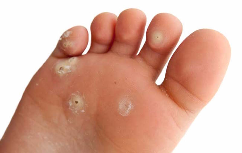 Ini Bahayanya Jika Malas Cuci Sepatu Ini Bahayanya Jika Malas Cuci Sepatu