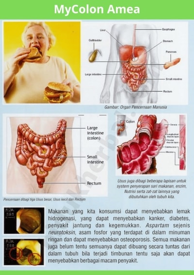 Gambar MyColon Amea