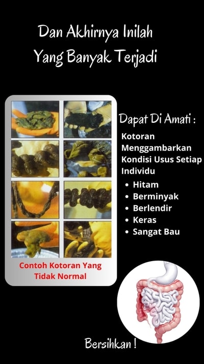 Gambar MyColon Amea