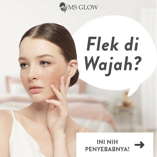 Cream Untuk Flek Hitam Yang Bagus - Elmoni